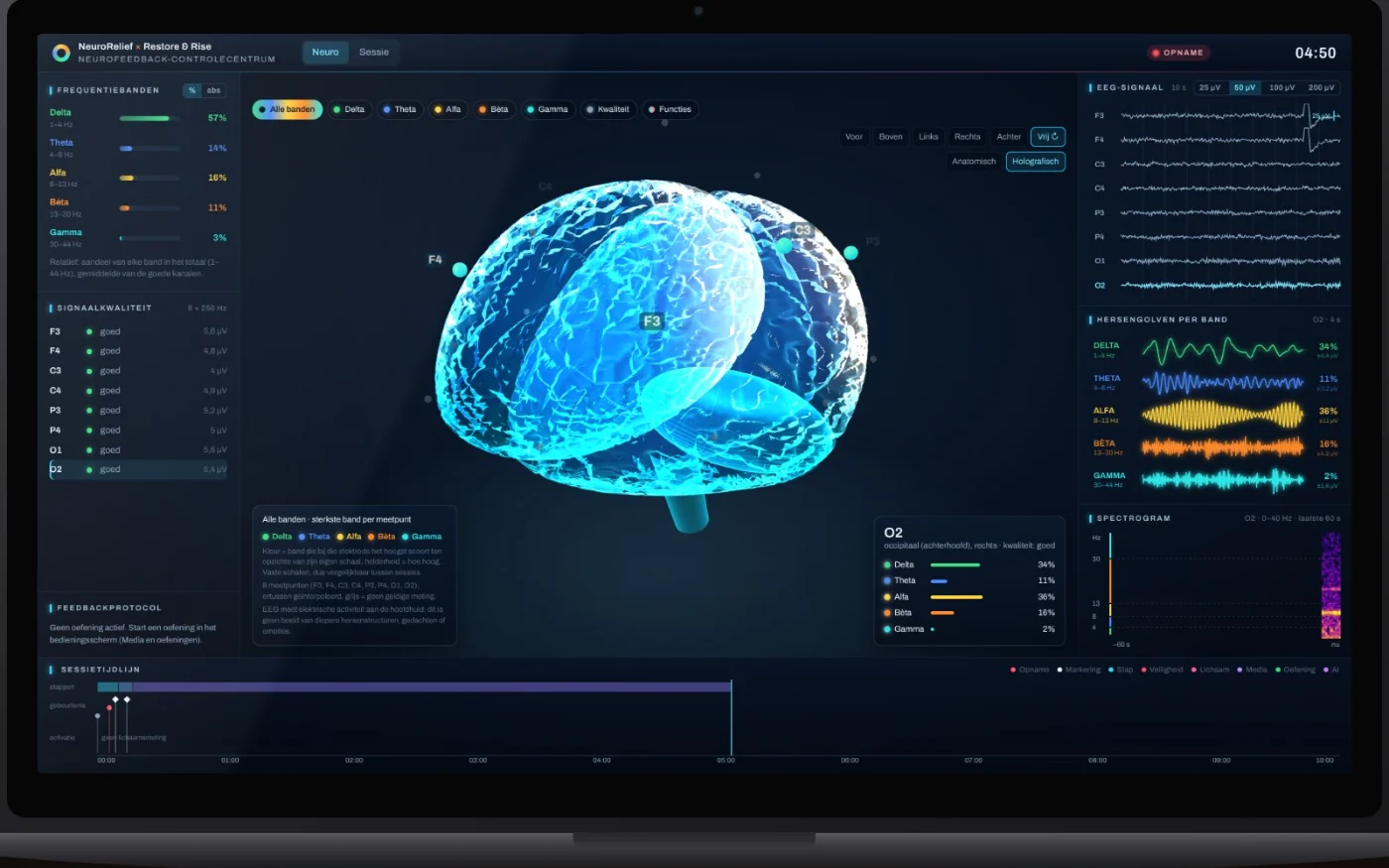 Laptop met een neurofeedbackscherm